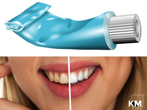 best teeth whitening toothpastes in kenya 2023 kenyan magazine