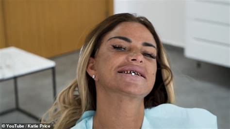 Katie Price Spits Out Her Old Teeth As She Gets Her Veneers Replaced In