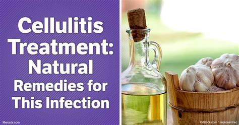 Try These Natural Alternatives For Cellulitis Treatment