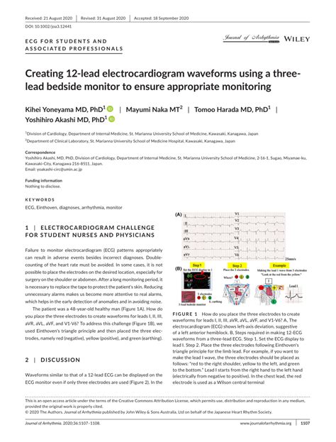 Pdf Creating 12‐lead Electrocardiogram Waveforms Using A Three‐lead