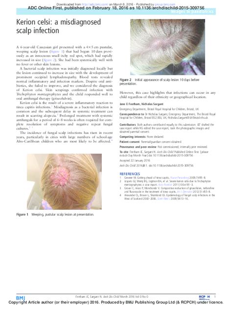 Pdf Kerion Celsi A Misdiagnosed Scalp Infection Megamind Harvey