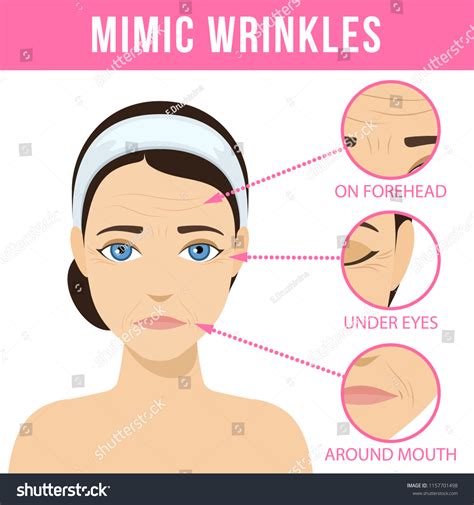 Different Types Facial Wrinkles Agerelated Skin Stock Vector Royalty