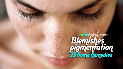 Best Ever Home Remedy To Remove Blemishes Dark Spots And Age Spots