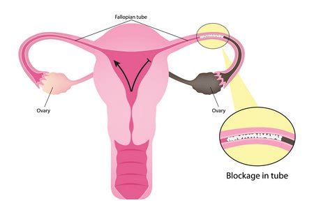 Best Fertility Centre In Karimnagar High Risk Pregnancy Best Fertility