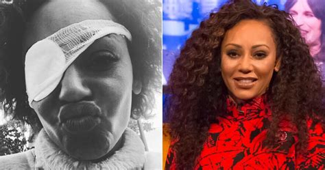 mel b reveals the real truth behind lost eyesight reports ahead of spice girls tour huffpost