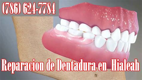 Reparacion De Dentadura Postiza Y Protesis Dentales Laboratorio Dental Mecanico Dental En
