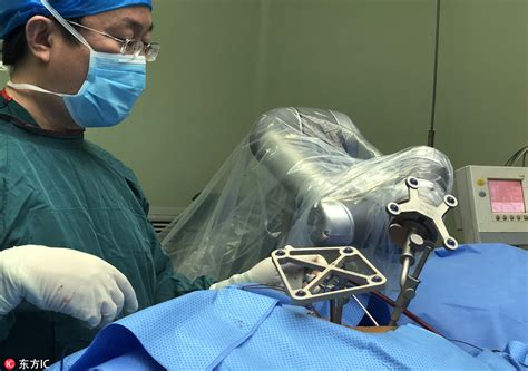 First Robotic Surgery In China A Success Cn