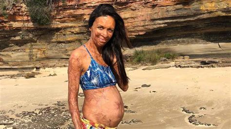Pregnant Turia Pitt Has Revealed The Joy That Motherhood Brings To Her Life Oversixty
