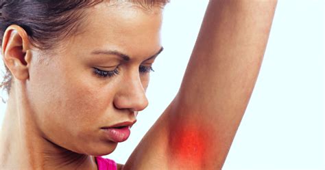 Douleur Aux Aisselles Symptômes Causes Traitements