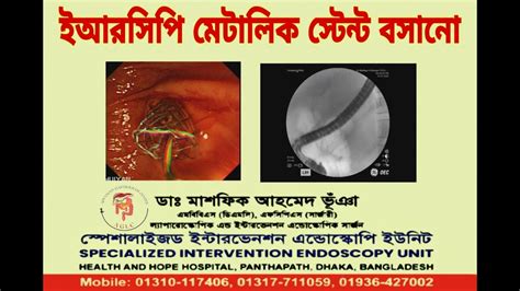 Metallic Stenting Dr Masfique Ahmed Bhuiyan Fcps Best Ercp In