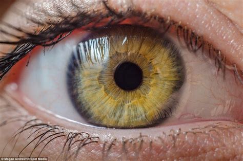 Incredible Photographs Reveal Stunning Unique Quirks Of Our Eyes Rare