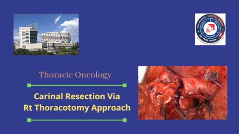 Carinal Resection Via Right Thoracotomy Approach Youtube