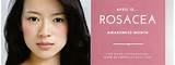 Images of Rosacea Makeup Brands