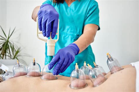 What Are The Different Types Of Cupping Therapy Articles Spin