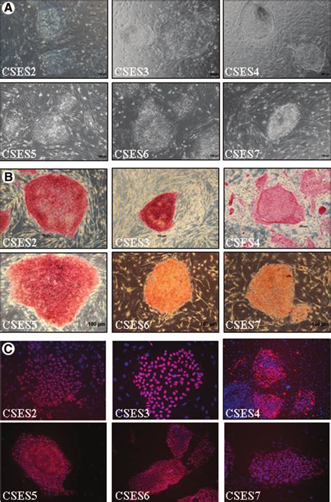 The Cses2cses7 Cell Lines Exhibit Markers Of Undifferentiated Human
