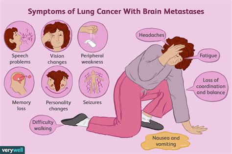 Lung Cancer Reaches Brain Lung Cancer Spreads To Brain And Its Symptoms