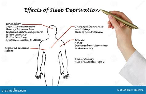 Effects Of Sleep Deprivation Stock Photo Image Of Adhd Irritability