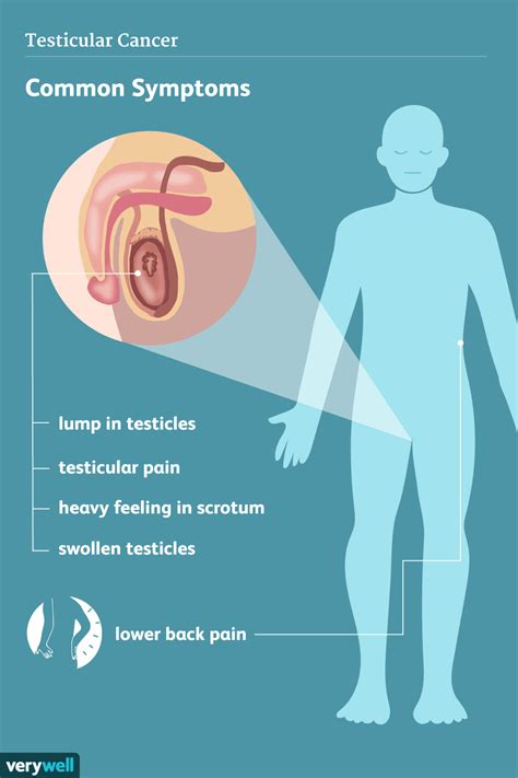 testicular cancer signs symptoms and complications