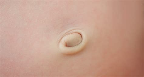 Will My Baby S Belly Button Always Stick Out Babycenter