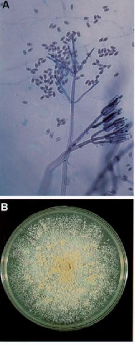 Gliocladium Roseum A Verticillate And Penicillate Conidiophores And