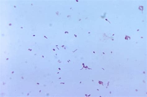 Free Picture Gram Positive Clostridium Tertium Bacteria Blood Agar