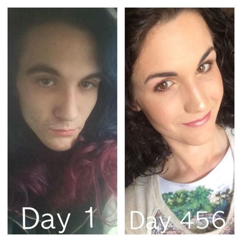 Albums Pictures Mtf Hrt Before And After Pictures Updated