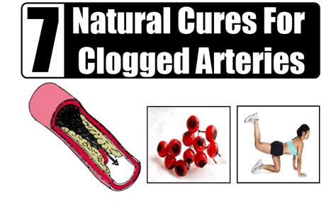 A majority of the symptoms associated with clogged neck arteries are related to brain function. 6 Valuable Natural Cures For Clogged Arteries - Natural ...