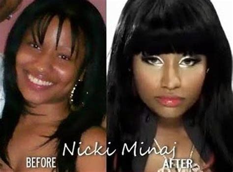 Celebrities Nicki Minaj Plastic Surgery Before And After Pictures 2012