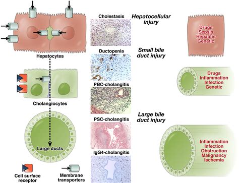 Pathogenesis Of Cholestatic Liver Disease And Therapeutic Approaches