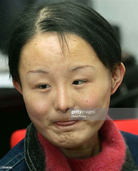 Chinese Woman Zhang Jing Known As The Ugly Girl Relaxes Before News Photo Getty Images