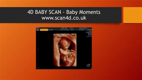 Amazing Ultrasound Scan Uk Call 08000075076 Youtube