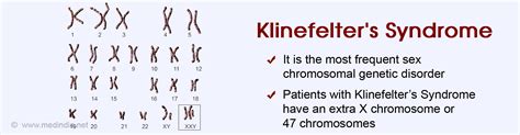 Klinefelters Syndrome Causes Symptoms Diagnosis Treatment