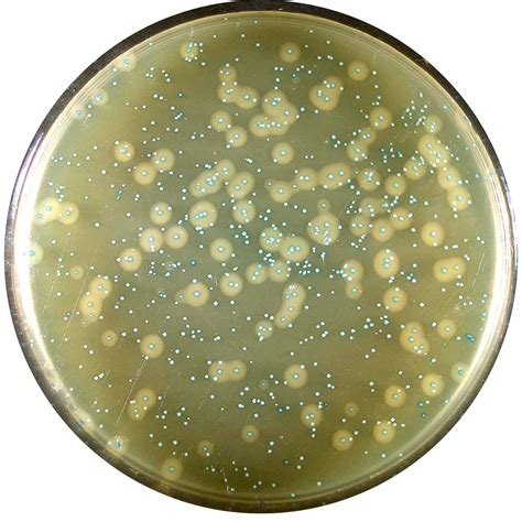Aloa Agar Listeria Acc To Ottaviani And Agosti Biolife Cromogeni
