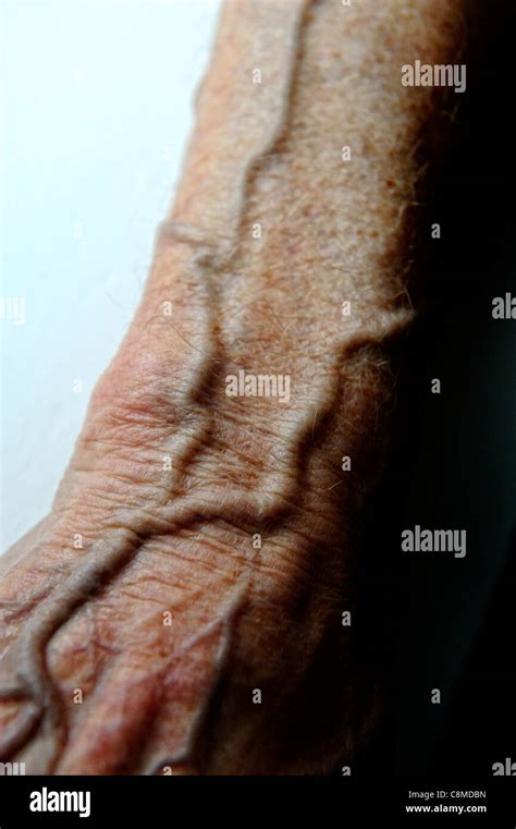 Veins Arm High Resolution Stock Photography And Images Alamy