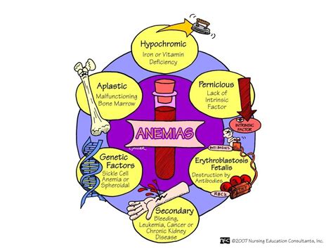 Anemias Nursing Mnemonics Hematology Nursing Nurse