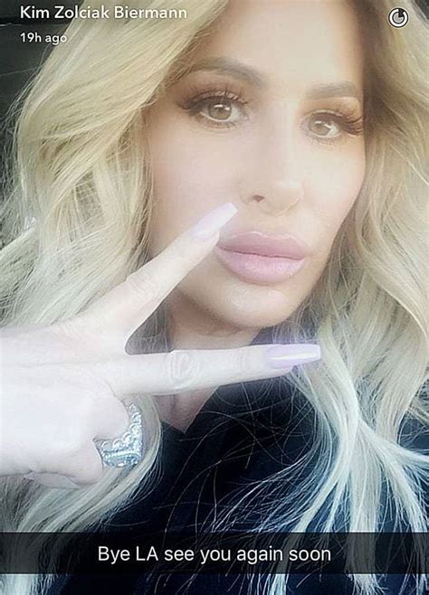 kim zolciak got her lips done and they are swollen