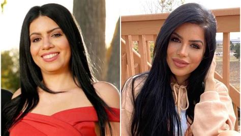 Photos Larissa Limas Plastic Surgery Before And After