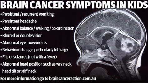 Brain Tumours Are The Biggest Cancer Killer Of Children And The