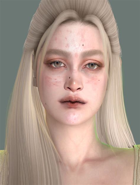 Acne Facial Face Acne Acne Skin Pimple Scars Pimples On Face Sims
