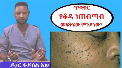 ይህ ጥቋቁር የቆዳ ነጠብጣብ መፍትሄው ምንድነው Dermatosis Papulosa Nigra Dpn In