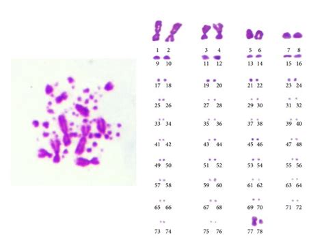 karyotype of chicken cspcs ♀ zw type the diploid chromosome number download scientific