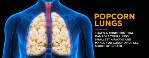 Is It True That Vaping Can Cause Popcorn Lung — Freeman