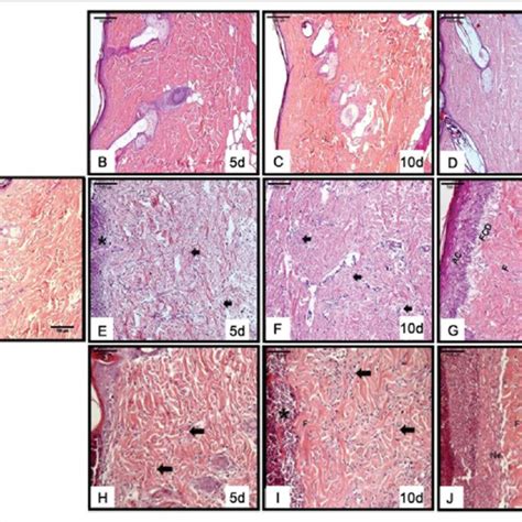 Photomicrographs Of Histological Sections Stained With He A Control