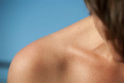 Collarbone Clavicle Pain Causes Symptoms And Remedies
