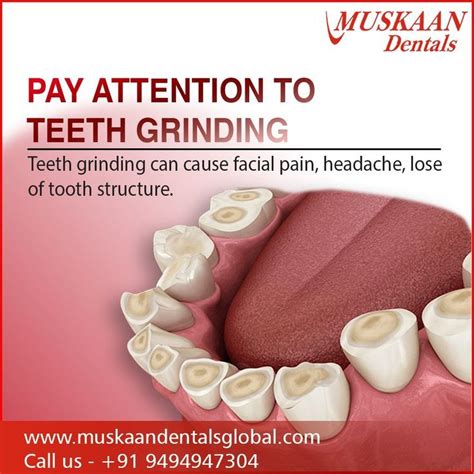 Excessive Grinding Of The Teeth Or Clenching Of The Jaw Is A Serious