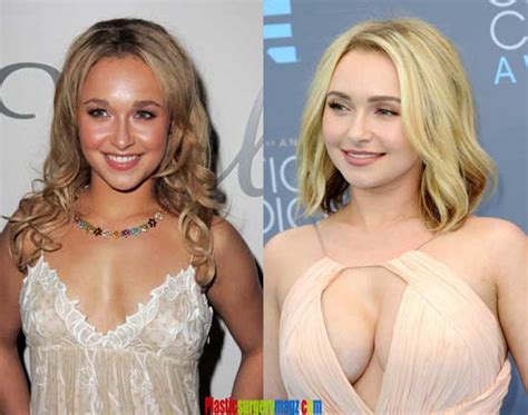 Hayden Panettiere Boob Job Before And After Plastic Surgery Magazine