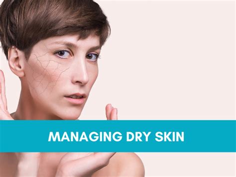 19 Tips On Handling Dry Skin Dry Skin Management In Sjogrens