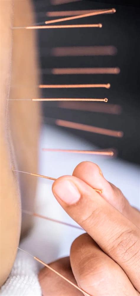 Acupuncture Points For Men