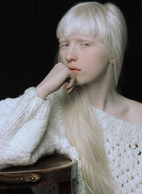 Albino Girl Albino Model Albinism