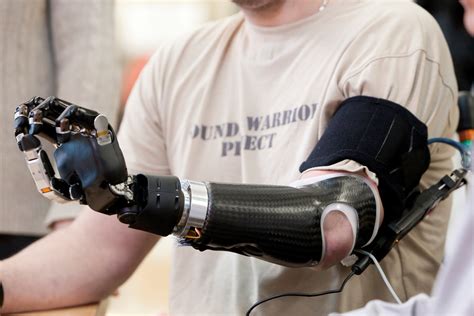 Robotic Prosthetics Technology For The Future Is Now — Gizhub
